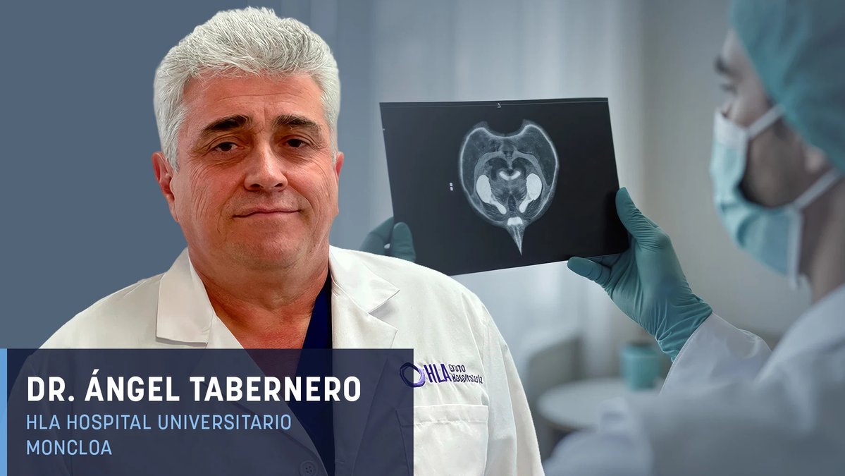 GrupoHLA's tweet photo. 🩺 El Dr. Ángel Tabernero, responsable del servicio de urología de #HLAUniversitarioMoncloa, nos habla para @okdiario de cómo el cáncer de próstata diagnosticado a tiempo se cura en más del 90% de los casos y de la cirugía robótica para su tratamiento👇

https://t.co/dzmjnze0eh https://t.co/SqoiMAwsEZ