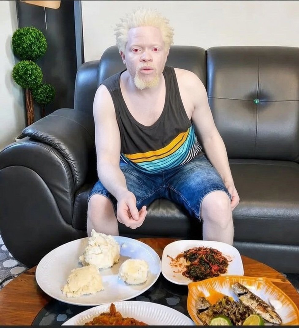 Hump016's tweet photo. Dotto Magari angekuwa albino https://t.co/ZWp5u8md95