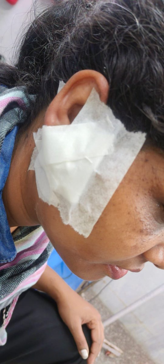 scribe_anjali's tweet photo. Woman with ruptured ear: 'Went to Jantar Mantar to raise my voice. What did I do for cops to fire at me?'

https://t.co/m8gbc9IcVT

#jantarmantardehli 
#ProtestAgain 
#education
#cjp https://t.co/OAGbdFG3Oi