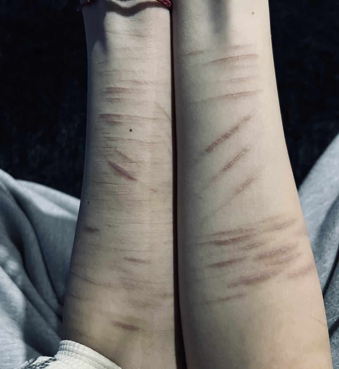 sleeppslol's tweet photo. pelee con un gato y gane btw ʅ（◞‿◟）ʃ mini scarspo¿ https://t.co/qG08l3gvbX