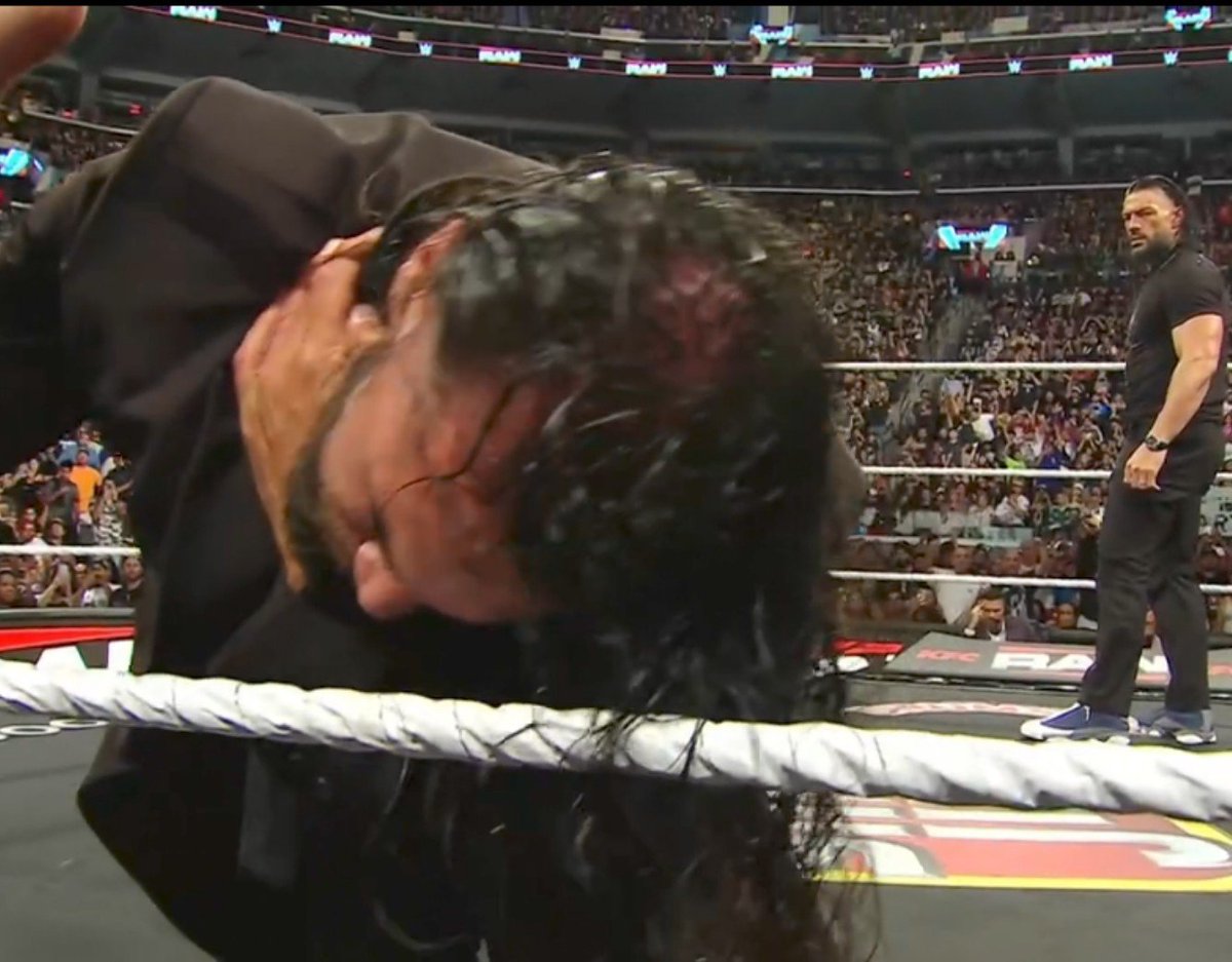 TheHulchal's tweet photo. Had no idea that Seth Rollins is also suffering from hair fall 😭 

Don't be surprised to see him going full bald like Triple H in a few years.

#WWERAW https://t.co/r40tWD1lMz