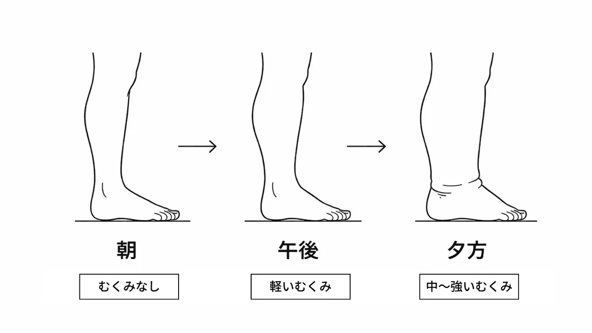 finetuning_jp's tweet photo. 夕方、靴を脱いだ瞬間に足がパンパン…

「水分の摂りすぎかな」って思ってませんか？実はそれ、正確じゃないんです。

立ち仕事で足がむくむ本当の原因は「重力」と「ふくらはぎのポンプ不足」。

朝から少しずつ溜まっていった水分が、夕方に一気に表に出てくるだけ。しかも足裏のアーチが崩れてると、そのポンプがさらに弱くなる。

日中のちょっとした動きと、帰宅後のリセットで、翌日に持ち越さない足は作れます。

詳しいメカニズムと、すぐにできる対策は記事にまとめました↓ 立ち仕事の人、ぜひチェックしてみてください。