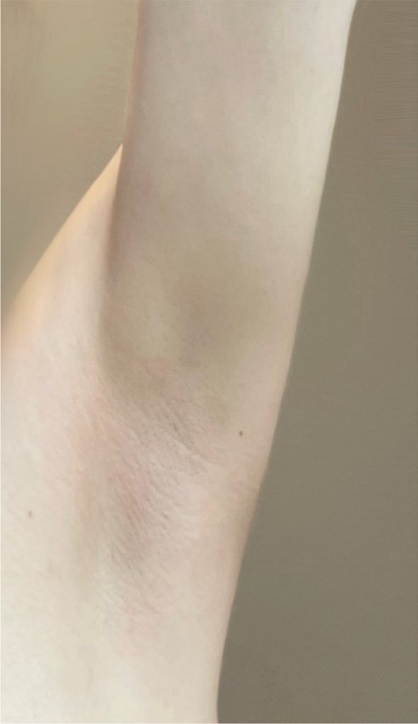 armpit_moe's tweet photo. armpit Hair Removal
A little gross https://t.co/ey8Sm95DWk