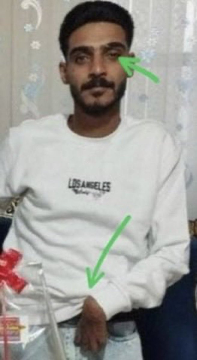 RiseofAziola0's tweet photo. تو تاریخ بنویسید جوان معلول، امیرحسین صفاری رو به جرم واهی کشتن مامور تا دندان مسلح رژیم اعدام کردند. https://t.co/xTEJp8dklj