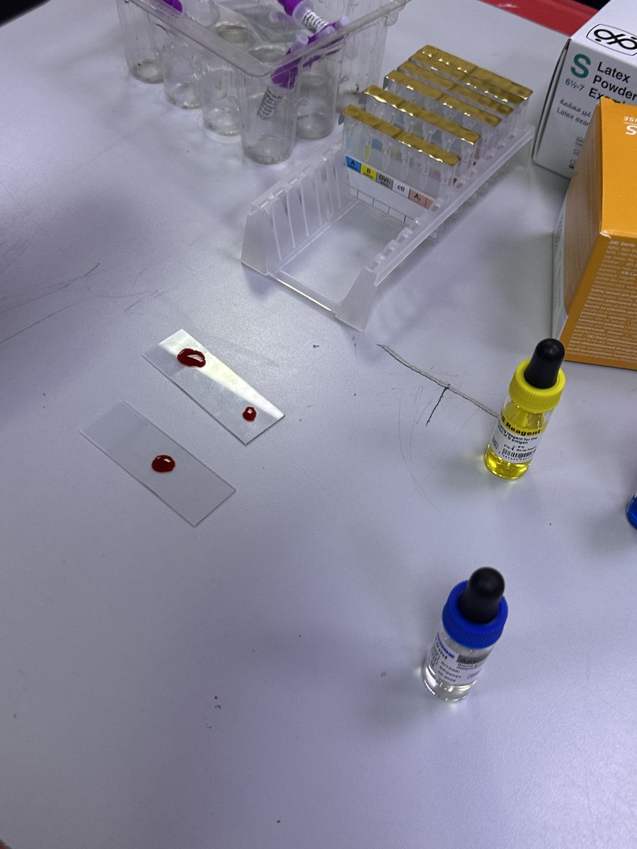 Lamy434's tweet photo. تحديد فصيلة الدم 🩸. https://t.co/taRQUJEDXx