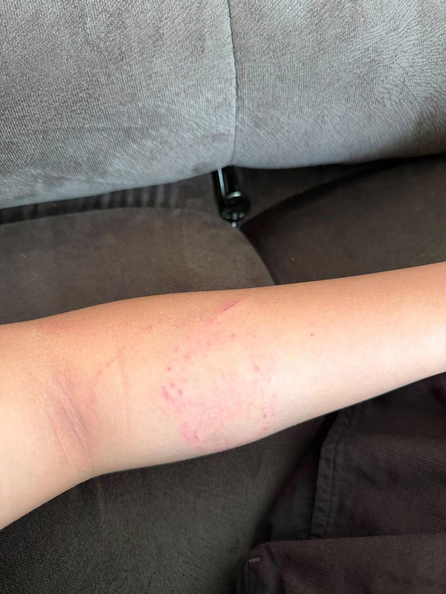 recehsjaa's tweet photo. BANTU UPPP

teman saya menjadi korban penganiayaan oleh SEORANG DOKTER SPESIALIS KANDUNGAN. teman saya sampai mengalami patah tulang di hidung dan memar parah di beberapa bagian tubuh! SEKALI LAGI SEORANG DOKTER BISA MELAKUKAN HAL SEPERTI ITU?

Laki2 ini seorang dokter spesialis kandungan berinisial L yang aktif praktik di rumah sakit terkenal di Bekasi Barat dan rumah sakit milik Pemerintah di Jakarta Utara.

Laki-laki ini merasa aman karena dia punya kaka laki2 yang bekerja sebagai polisi.

cc:jellyfish.45719234