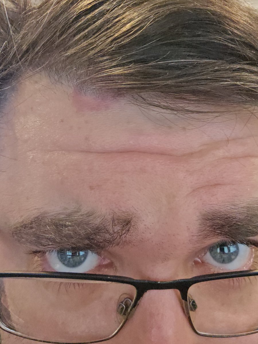 TheChowderhead's tweet photo. Fun fact: paintball masks don't cover the whole face.

Ask me how I know. https://t.co/XV6kHb8f6E