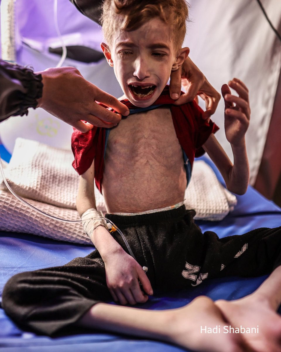 hadishabanih's tweet photo. One day, history will ask a simple question:

When children were starving, wounded, and terrified by war, where was the world?

And what will our answer be?

#Humanity #ChildrenOfWar #Peace #hadishabani #gaza #Palestine https://t.co/VFQIT9zg1z