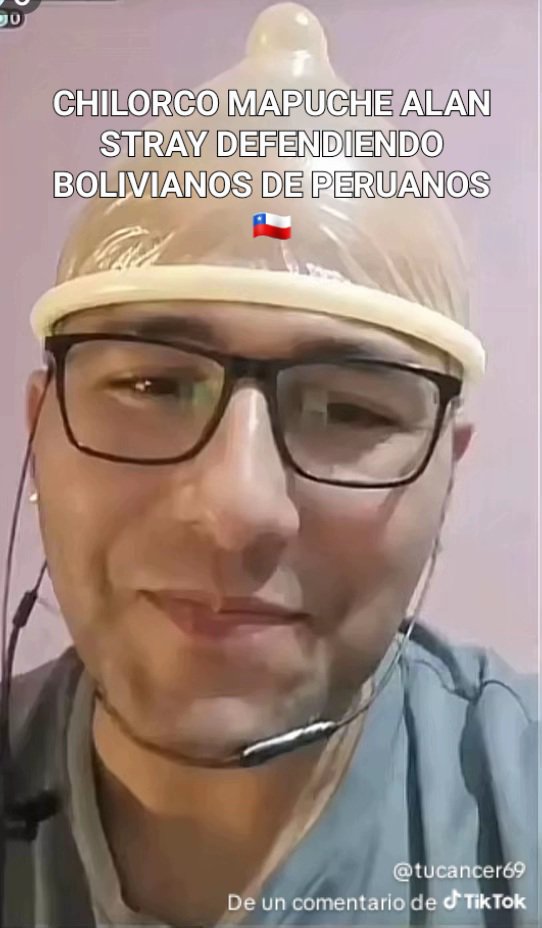 LupusVantrell's tweet photo. @iamelikin @ivangullina @AtaqueFutbolero Chilindio asqueroso tu paisnesta tomado por los zi mi oz venezolanos,2 chilindios fueron quemados por un boliviano en oruro cholevea y algunosntienen carita de edwin toledo y yanara aedo no fuiste al mundial por 12 años jajaajaj https://t.co/HwS0qziRTK