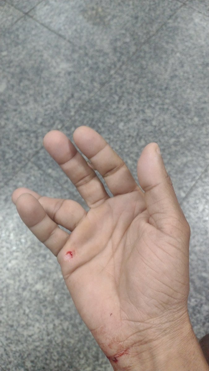 AlecsandrodeAn7's tweet photo. Essa maldita lâmpada,me causa uma queda de risco 
Sem escada,uma simples cadeira me joga no chão,quase arrancando lâmpada no banheiro https://t.co/nSNReVy3j7