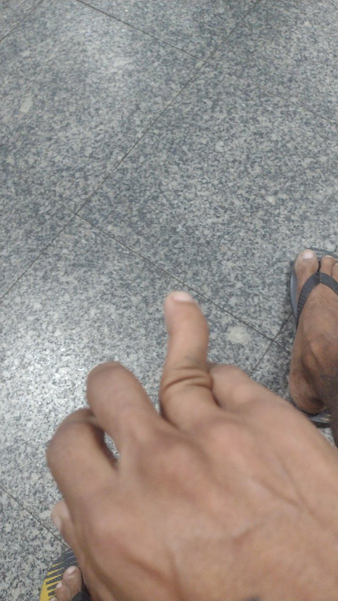 AlecsandrodeAn7's tweet photo. Essa maldita lâmpada,me causa uma queda de risco 
Sem escada,uma simples cadeira me joga no chão,quase arrancando lâmpada no banheiro https://t.co/nSNReVy3j7