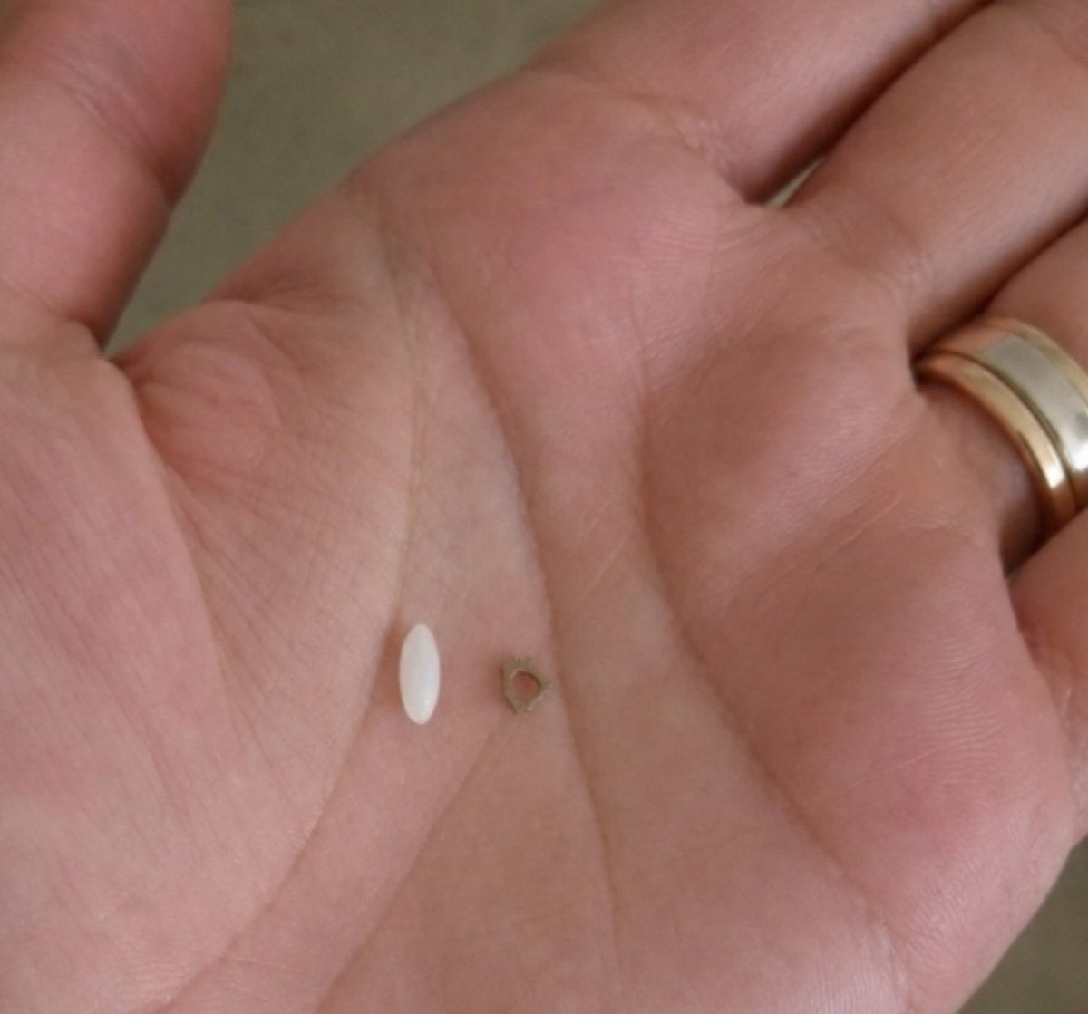 Toughtaskx's tweet photo. The smallest bone in the human body is smaller than a grain of rice. Hey @grok Do you know where it is? https://t.co/p8cOsJb35P