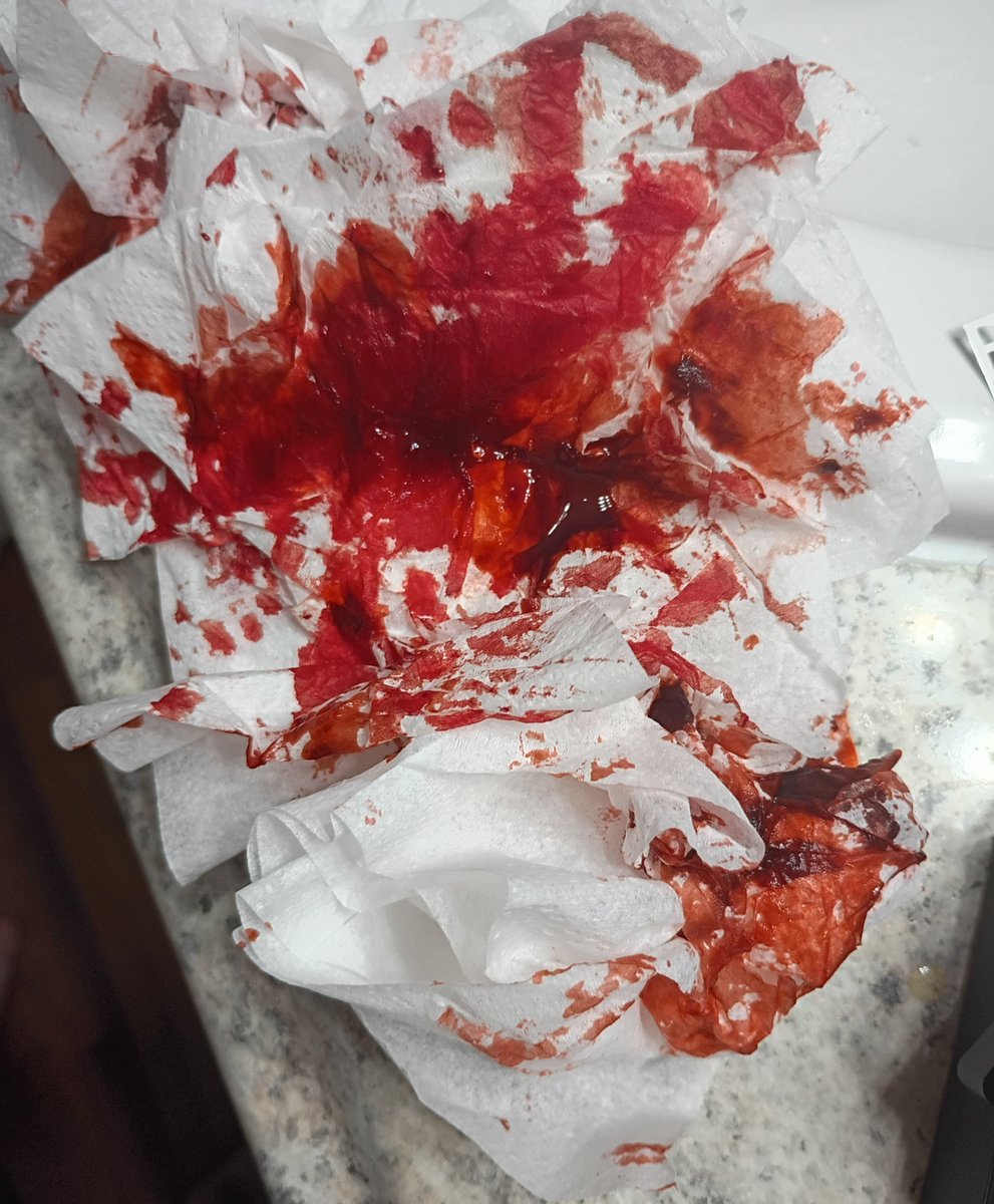bread10ver's tweet photo. So I hit 🫘 while tye dyeing it looks like jam #shedtwt #slittwt #shtwt 

ITS PAINT!!! ITS AI TYE DYE https://t.co/cKxzBd8Ige