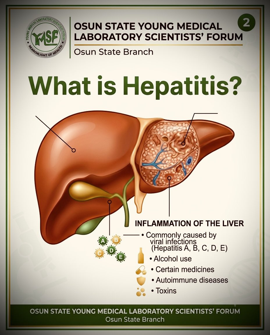 OsunYMLSF's tweet photo. World Hepatitis Day

Hepatitis can be silent, but early testing saves lives.

Know your status. Protect your liver.

Swipe through, learn something new, and help spread awareness by reposting.

Repost✨✨✨ https://t.co/Af4pt4CpDf