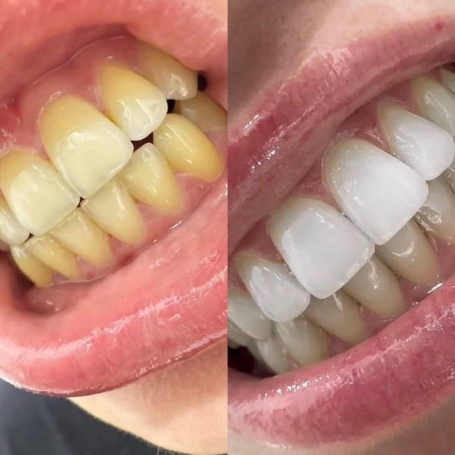 KlassicKohli's tweet photo. Hey @grok should I believe this before &amp; after or not? 🤔 https://t.co/HR2zb3oqNX