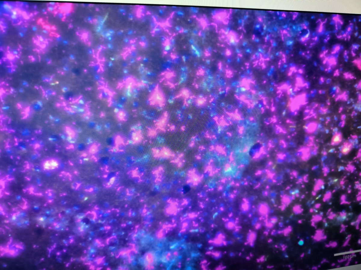 AmandaSSaavedra's tweet photo. Atención, amantes de la Neurobiología!

Buscamos candidatos para una beca #FPI para hacer una tesis doctoral en factores  de riesgo de enfermedad  neurodegenerativas, enfocado en el desarrollo temprano de la #microglia en el centro vasco de Neurociencias @AchucarroGlia https://t.co/hQlzicsZoM