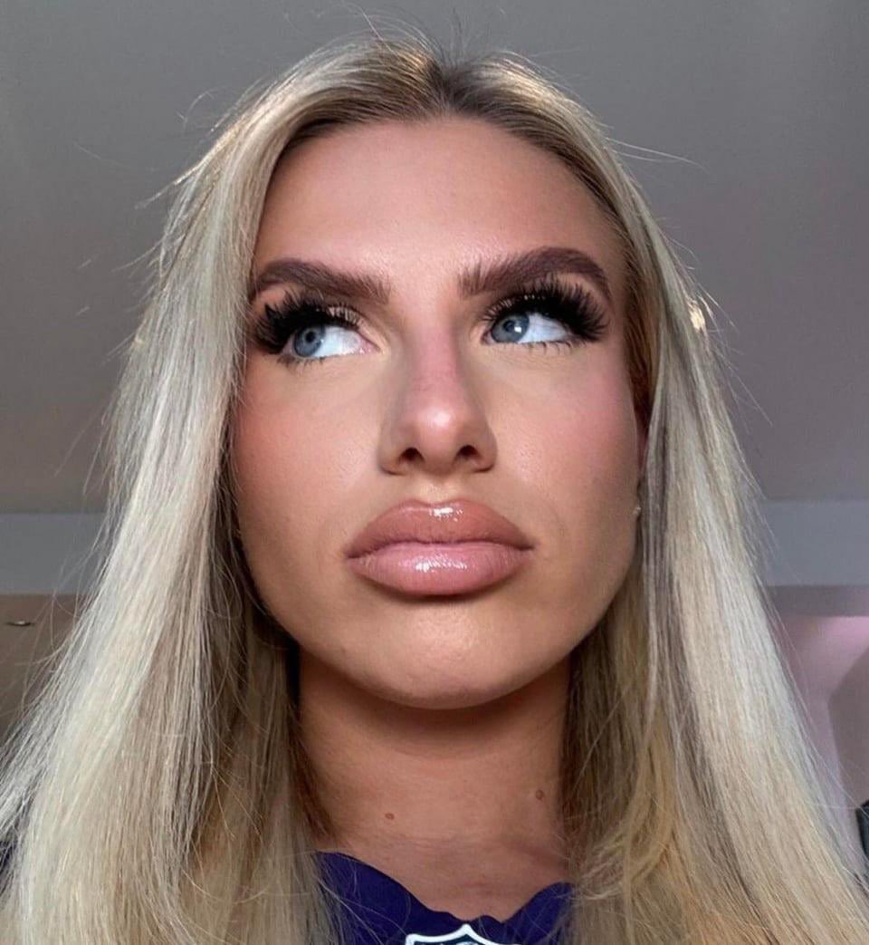 L_9891's tweet photo. Chloe’s lips 😵‍💫😵‍💫 https://t.co/1CtYCjuOVG