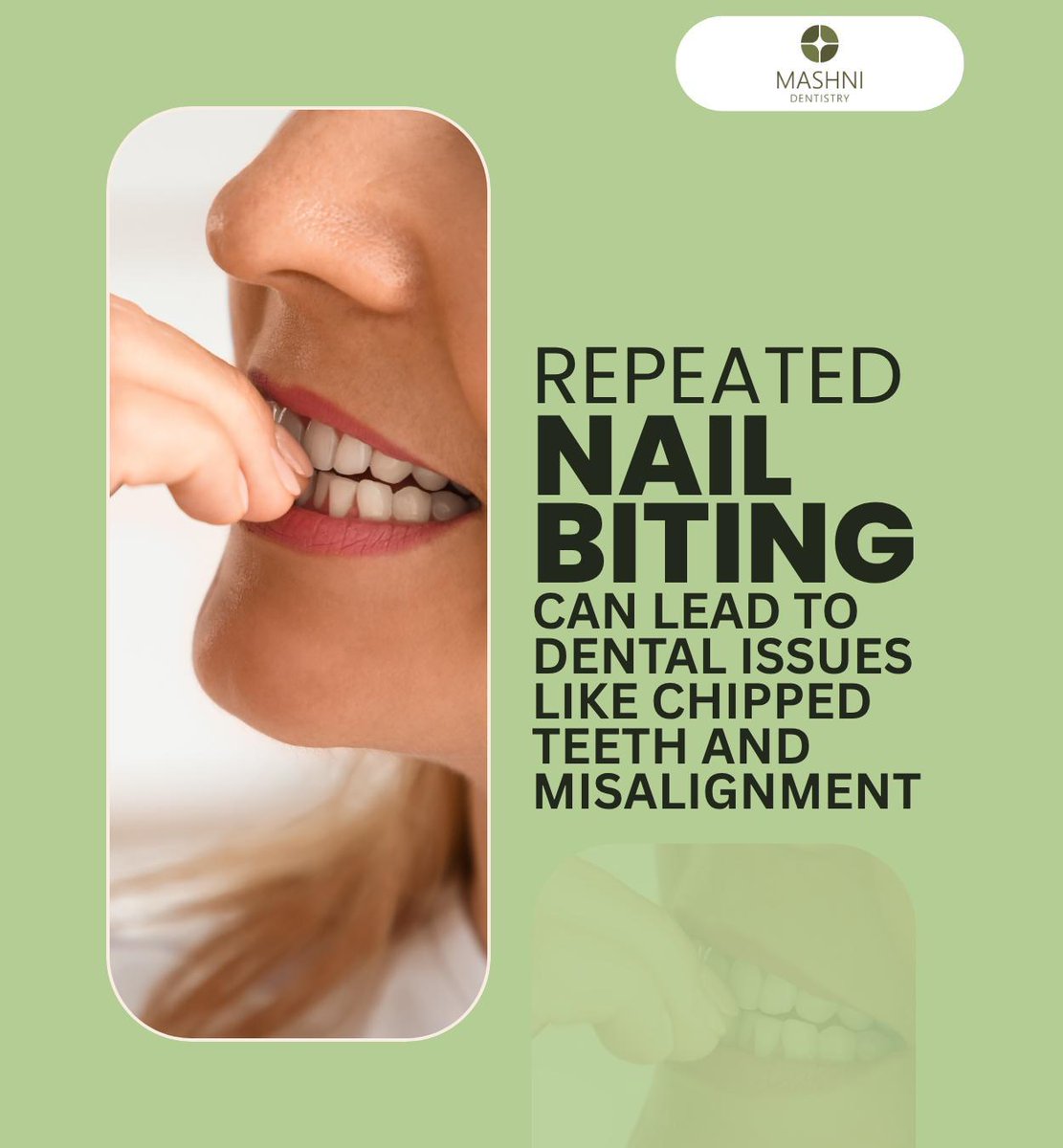 MashniDentistry's tweet photo. Nail biting is a habit that can be difficult to stop, but it can lead to chipped teeth, dental misalignment, and also spread bacteria to your mouth.

https://t.co/f0EQFl3cC7

#nailbiting #dentalmisalignment #stopnailbiting #MashniDentistry #Lansing #EastLansing #MI https://t.co/EZ2iYstRlr