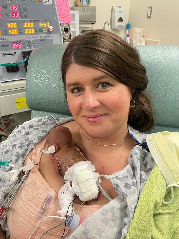 Maazijnr's tweet photo. One year ago, Nash Keen was recognised as world's most premature surviving baby.
Born at just 21 weeks, today he celebrated his second birthday. https://t.co/bBquRQItnL