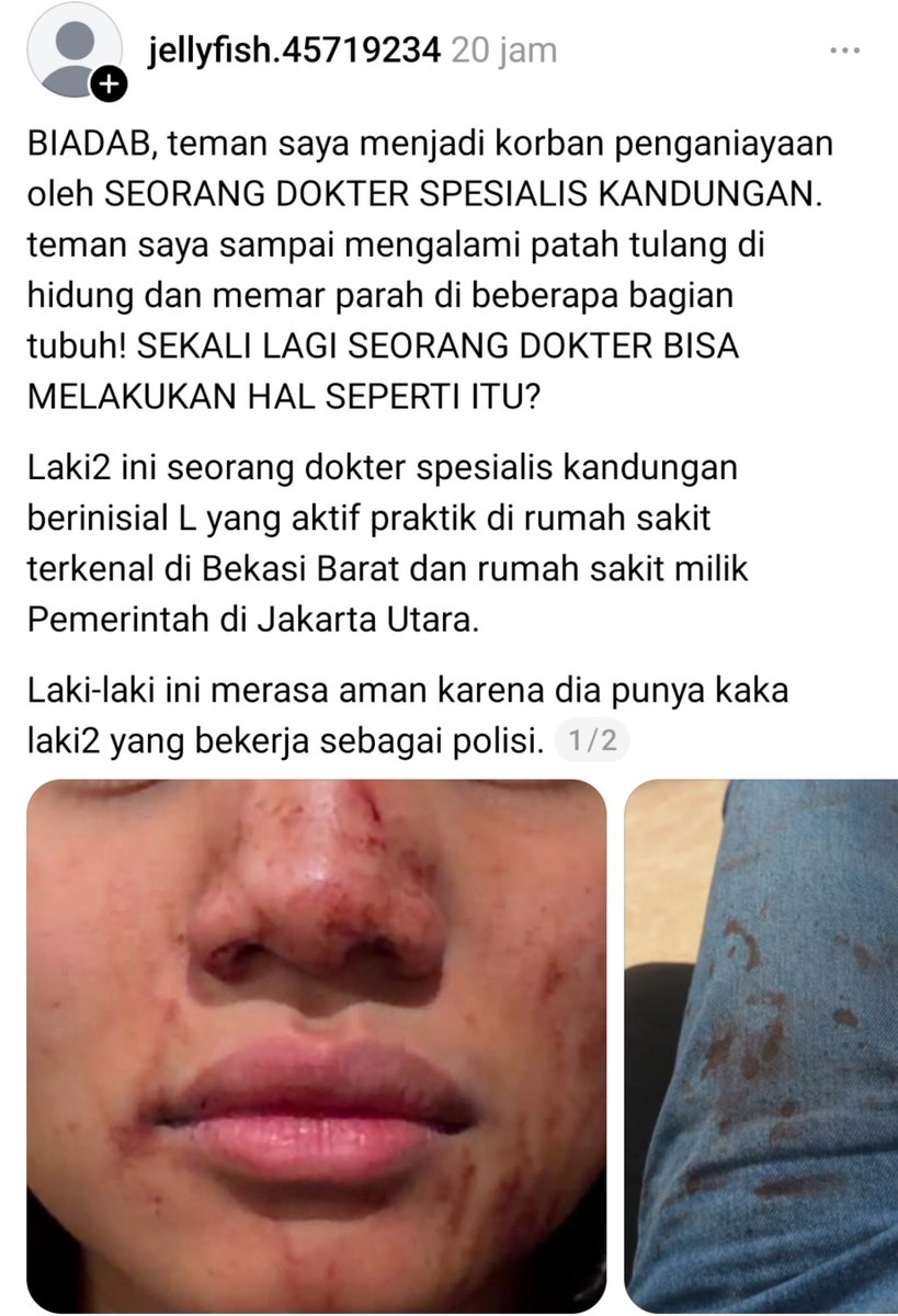 NakesPuskesmas's tweet photo. Rangkuman singkatnya:
1. Terduga pelakunya dr. Anggi Lewis, SpOG
2. Praktik di RSUD Priok dan Hermina Bekasi
3. Ibunya punya RS dan dokter obgyn juga
4. Kakaknya isilop
5. Suka main tiktok
6. IG dan sosmed lainnya menghilang

Kacau sih dokter obgyn yang notabene sering berinteraksi dengan ibu dan bayi bisa kayak gini ke perempuan 😔