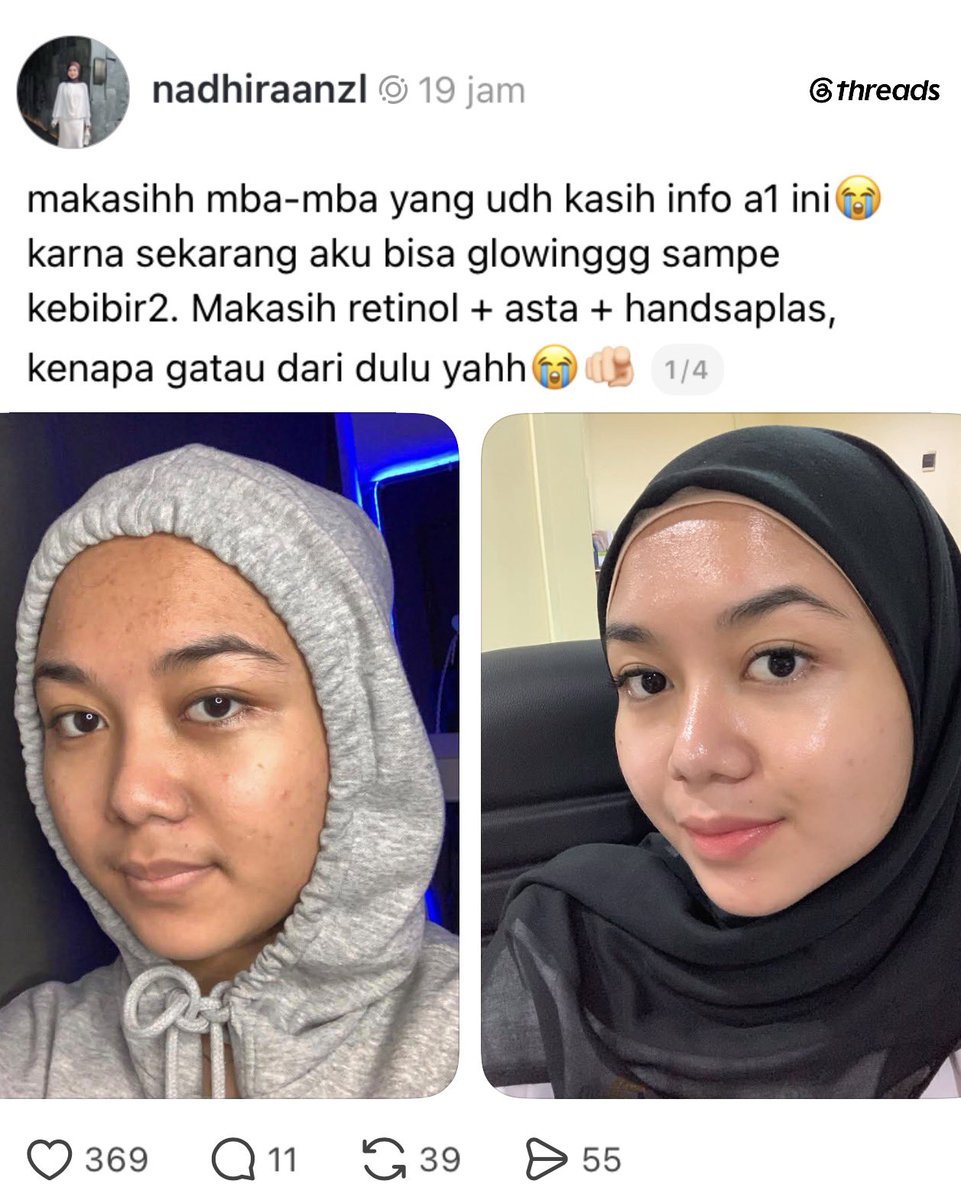 xurentpost's tweet photo. MAKASIH JUGA MBA UDAH LEWAT DI TIMELINE, AKU JADI TAU RAHASIANYA😭😭 https://t.co/xGdMOmQ17S