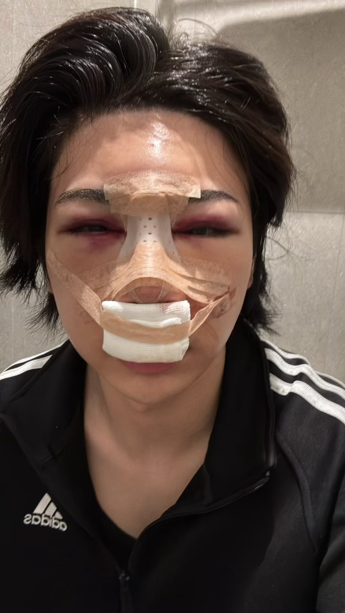 1ovedope's tweet photo. 鏡見て病んで心ギリギリ(笑) https://t.co/BZLFN4oDsO