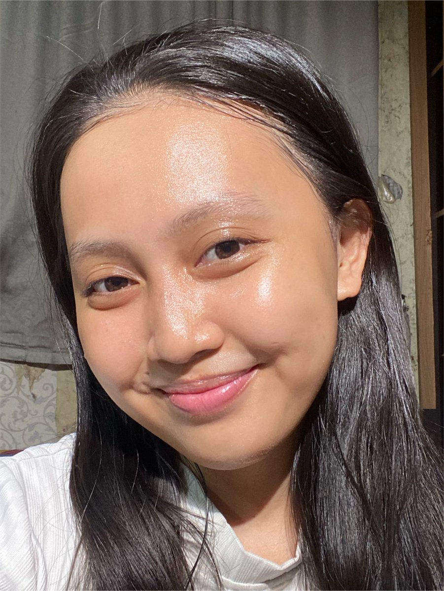 behappyeaah's tweet photo. Punya kulit berminyak atau berjerawat? Gak perlu skincare bertumpuk-tumpuk 😩

dulu jerawat + minyak berlebih ini bikin gue insecure parah, udah coba banyak produk tapi hasilnya gitu-gitu aja, untung udah nemu best combo sekarang https://t.co/uuPw41Vwqm