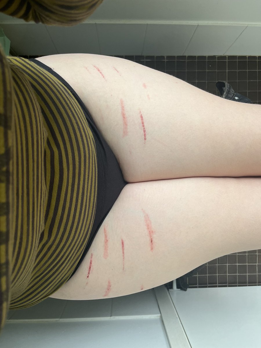 aaronshedtwt's tweet photo. lowk reminiscing on the first time i sh’ed like omg the’re so cute and shallow! and on a fresh blank canvas, my thighs look so bare https://t.co/vTywlTX9jQ