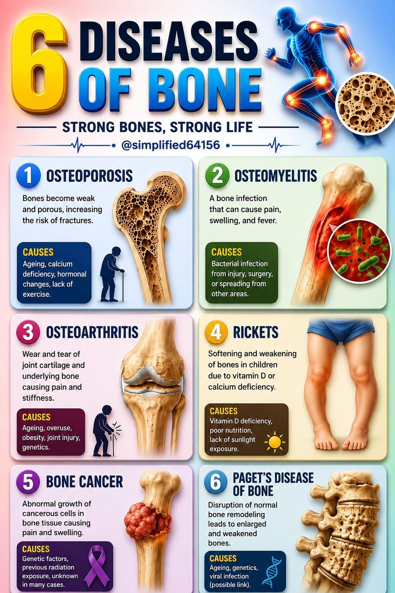 simplified64156's tweet photo. 🦴 Think your bones are healthy? These 6 bone diseases can develop silently! https://t.co/OSe9DKmThX