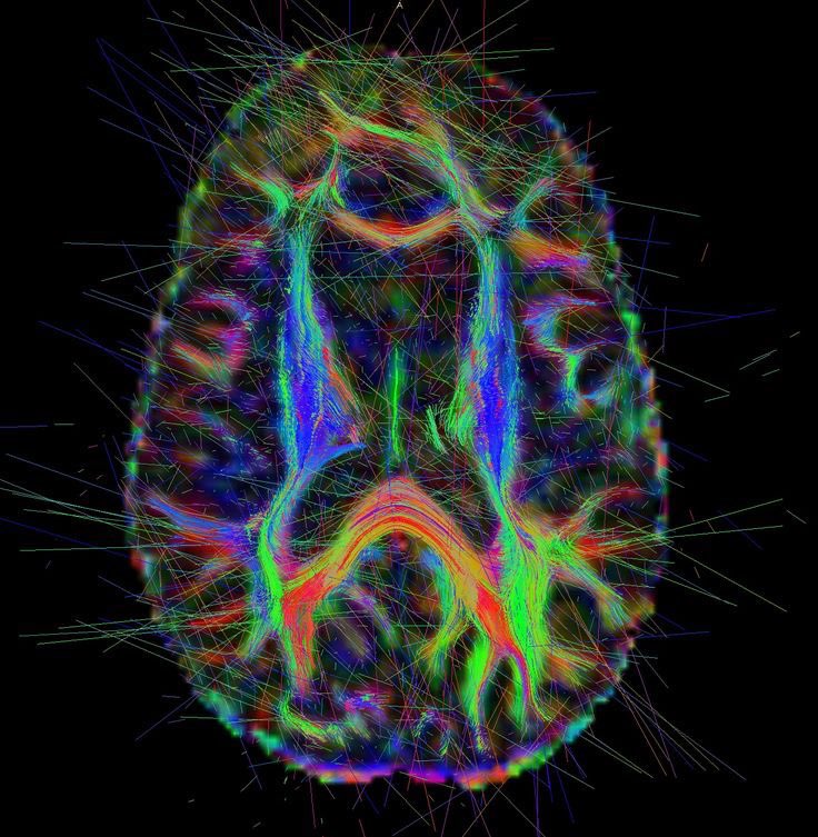 NightSkyToday's tweet photo. JUST IN🚨: Research has shown that the feeling of gratitude physically reshapes the brain.  

It has revealed that it makes a person more positive and resilient. https://t.co/SC8FDBeqRP