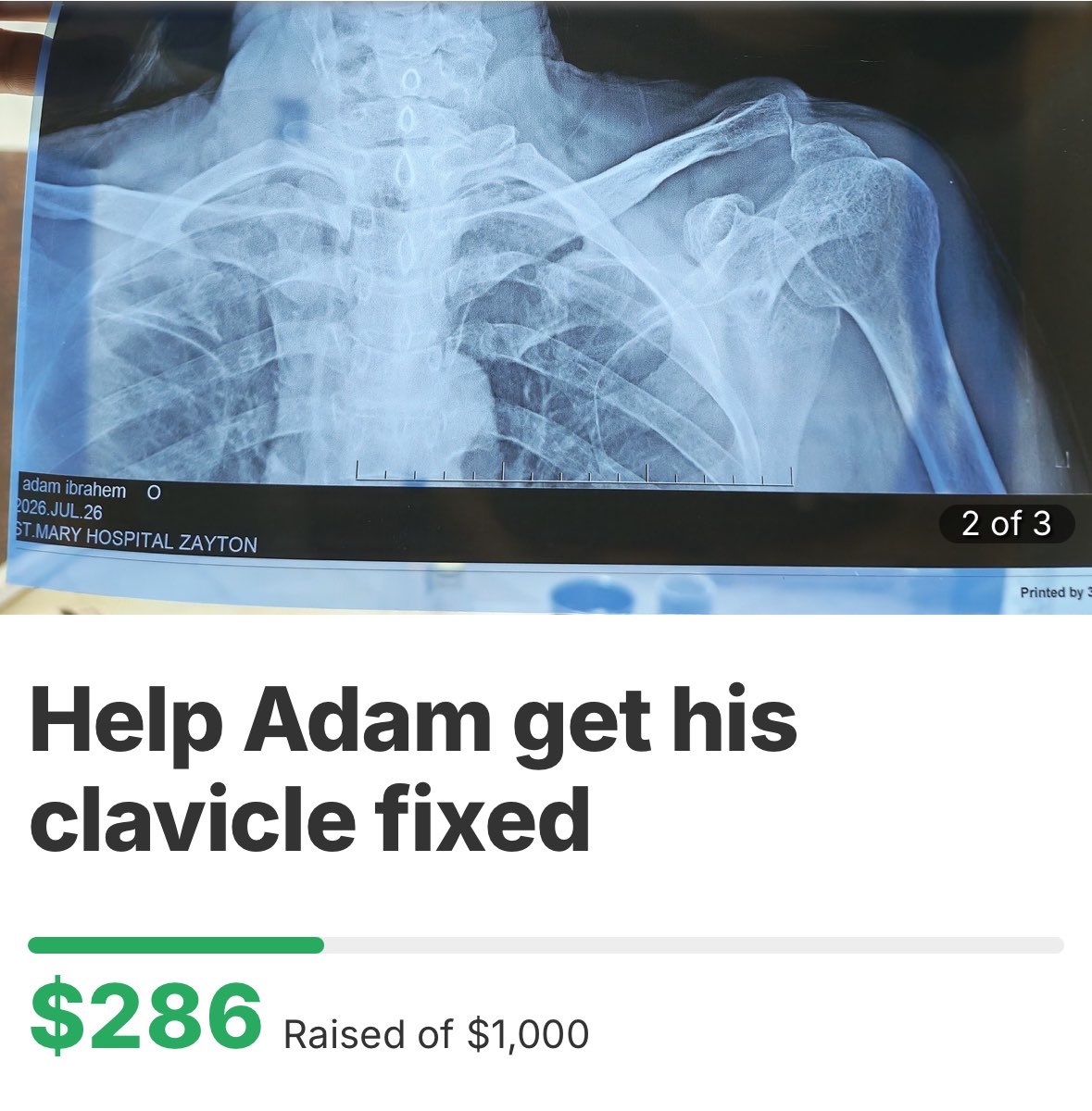 SimsimAlbadri's tweet photo. Adam is a Sudanese refugee living with a painful broken clavicle.
The goal is within reach let’s get him the surgery he desperately needs‼️ https://t.co/QRoXUOs4aM