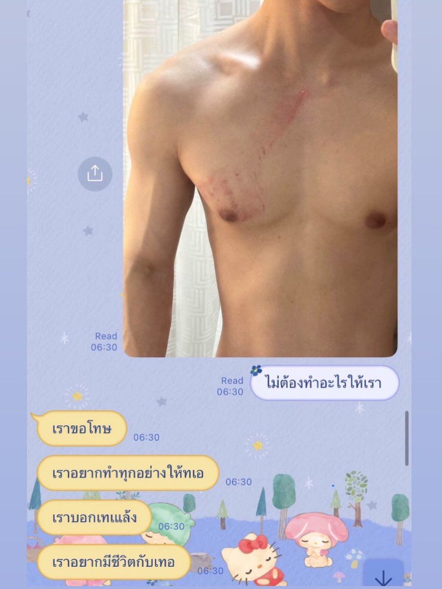 MBS_th38's tweet photo. สะเทือนวงการ! “ยูกิ ดุรงค์แสง” เปิดประสบการณ์ความสัมพันธ์ อ้างถูกอดีตแฟนดาราค่ายใหญ่ทำร้ายร่างกาย–จิตใจ เดินหน้าพึ่งกระบวนการยุติธรรม

กลายเป็นประเด็นร้อนในวงการบันเทิง หลัง “ยูกิ ดุรงค์แสง” นักแสดงและนายแบบ ออกมาเปิดเผยเรื่องราวความสัมพันธ์ในอดีต โดยกล่าวอ้างว่าเคยคบหากับบุคคลในวงการบันเทิงจากค่ายใหญ่ประมาณ 1 ปี ก่อนความสัมพันธ์จะเต็มไปด้วยปัญหา ทั้งเรื่องความไว้ใจ ความสัมพันธ์ซับซ้อน และความขัดแย้งที่ทวีความรุนแรงขึ้น

ยูกิระบุว่า ตลอดช่วงเวลาที่คบหากัน ตนต้องเผชิญทั้งการกระทำและคำพูดที่สร้างบาดแผลทางจิตใจหลายครั้ง ก่อนบางเหตุการณ์จะบานปลายจนถูกทำร้ายร่างกาย โดยเจ้าตัวได้นำภาพร่องรอยบาดแผลและรอยขีดข่วนตามร่างกายออกมาเผยแพร่ประกอบคำบอกเล่าของตน

นอกจากนี้ ยูกิกล่าวว่าได้ดำเนินการทางกฎหมาย โดยไปลงบันทึกประจำวันและยื่นฟ้องต่อศาลแล้ว พร้อมระบุว่าศาลได้รับฟ้องคดีดังกล่าว ขณะเดียวกันยังเคยพยายามติดต่อค่ายต้นสังกัดของอดีตคนรัก เพื่อแจ้งเรื่องที่เกิดขึ้นและสอบถามถึงแนวทางรับมือกับกรณีความรุนแรง แต่เจ้าตัวระบุว่ายังไม่ได้รับคำตอบที่ชัดเจนตามที่คาดหวัง

เรื่องราวดังกล่าวสร้างกระแสวิพากษ์วิจารณ์บนโลกออนไลน์ โดยเฉพาะประเด็น “ความรุนแรงในความสัมพันธ์” ซึ่งไม่ควรถูกมองข้าม ไม่ว่าผู้ถูกกล่าวหาหรือผู้เสียหายจะเป็นบุคคลเพศใด หรือมีชื่อเสียงมากเพียงใด

อย่างไรก็ตาม ข้อมูลเกี่ยวกับเหตุการณ์ขณะนี้เป็นข้อกล่าวอ้างจากฝ่ายยูกิ และการรับฟ้องของศาลไม่ได้หมายความว่าศาลมีคำพิพากษาว่าฝ่ายใดกระทำผิด จึงควรรอข้อเท็จจริง คำชี้แจงจากอีกฝ่าย และผลจากกระบวนการยุติธรรมก่อนสรุปความรับผิด

ยูกิยังฝากเรื่องราวของตนเป็นอุทาหรณ์เกี่ยวกับการเลือกคบคน โดยชี้ว่าภาพลักษณ์ที่ปรากฏต่อสาธารณะอาจไม่สามารถสะท้อนพฤติกรรมของบุคคลในความสัมพันธ์ส่วนตัวได้ทั้งหมด

ขณะนี้สังคมยังจับตาว่า อดีตคนรักที่ถูกกล่าวถึงและต้นสังกัดที่เกี่ยวข้องจะมีคำชี้แจงต่อประเด็นดังกล่าวอย่างไร ร่วมถึงคดีจะมีความคืบหน้าไปในทิศทางใดต่อไป #ทำร้ายร่างกาย #ความยุติธรรม #ดาราดัง #ทำร้ายร่างกายแฟนเก่า #ข่าวดัง
