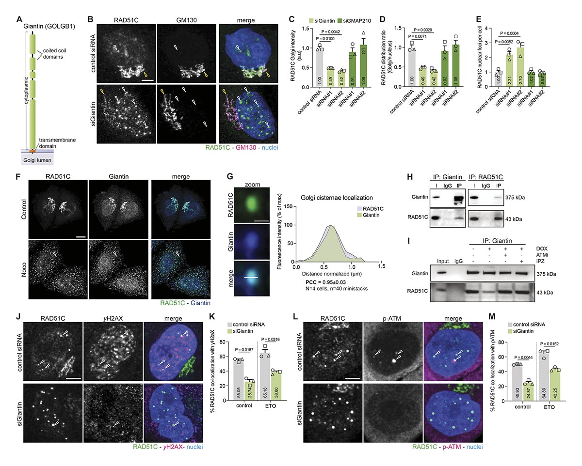 JCellBiol's tweet photo. George Galea, Karolina Kuodyte, Rainer Pepperkok et al @embl reveal that RAD51C is anchored at the Golgi by Giantin until DNA damage triggers ATM-dependent release & nuclear import, establishing the Golgi as a spatiotemporal regulator of nuclear #DNArepair https://t.co/m8O2RNNyGu https://t.co/Ck1jl7Mpzv