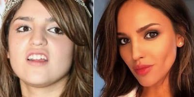 LimDimi's tweet photo. @estoenlinea @kamogu Eiza Gonzalez is a PLASTIC SURGEON CREATED FRAUD WHO CANNOT SING, ACT, or DANCE; MODELS like @eizamusica are a DIME A DOZEN in the #UnitedStates  . Time for @realDonaldTrump’s ICE squad to REVOKE #EizaGonzalez’ WORK VISA &amp; DEPORT HER BACK TO #Mexico . https://t.co/kU4tkODSHy