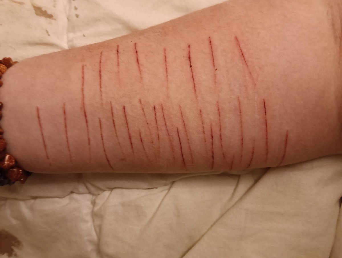 k1ttygrl_pompom's tweet photo. Guess which arm is my favorite level impossible!!! #shtwt #catscratches #sfx #sfxmakeup #fake #nonofthisisrealokaytwt #itsmakeup https://t.co/NNwRBBbznc