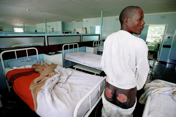 tafimhaka's tweet photo. In June 2000, ZANU-PF warlord Biggie Chitoro and party militia abducted MDC parliamentary candidate Finos Zhou and his brother James in Mberengwa West, Midlands Province.

For two days and nights, they stripped the brothers naked, beat them with an iron bar and burned them with melting plastic.

For two days and nights, Finos endured the beatings and burns, clinging to life before he died.

James crawled through the bush, his body flayed and burned, until he found help and survived.

The attack on the Zhou brothers became one of the earliest and most brutal acts of political violence in Zimbabwe's new millennium.

ZANU-PF militia abducted, tortured and brutalised ordinary Zimbabweans.

They murdered Finos Zhou.