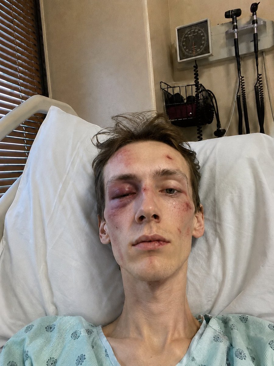 suedestiny0's tweet photo. @AllKnowingLib A photo I took of myself during a difficult moment after I was attacked by a rogue DGG member https://t.co/NDWGeVLJu4