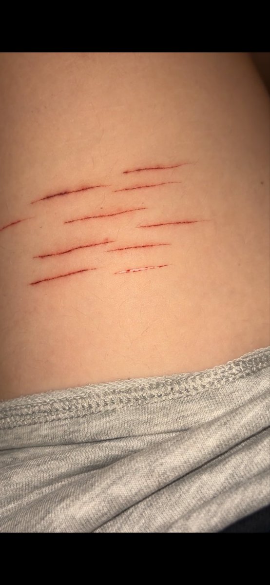 Lilaec_'s tweet photo. Some styros
I feel horrible today #shtwt https://t.co/GuL2NFymG4