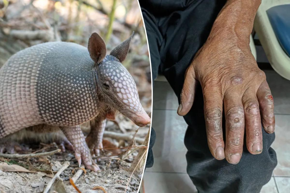 nypost's tweet photo. A biblical disease is back with a vengeance in Florida - experts warn which animal is to blame https://t.co/laX4Fnc5M1 https://t.co/CVca8Qvbwv