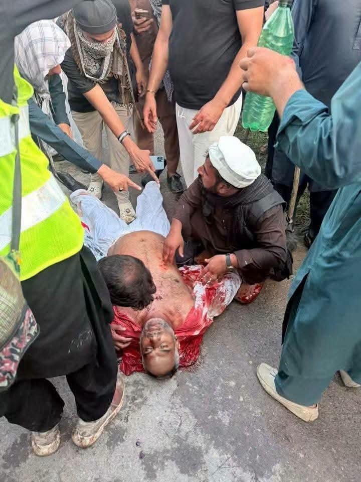 srrkaar's tweet photo. یہ جو ظلم فسطائیت بربریت کا کھیل تم کھیل رہے ہو اس کا بوجھ تم نہیں اٹھا پاو گے 
#rightsmovementajk #jammukashmir #mirpur #rawalakot #kashmirbleeding https://t.co/2KewMD2QyK