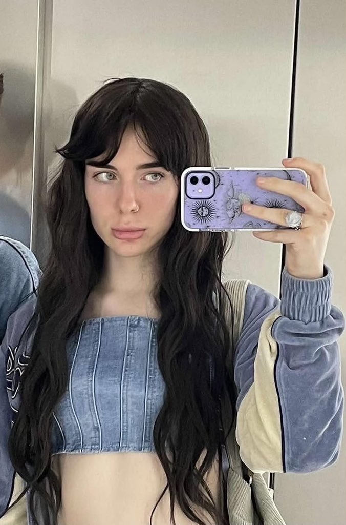 thewinterdollrx's tweet photo. Pre vs after 3 years of estrogen! 🏳️‍⚧️ https://t.co/KfLsJzG7gi