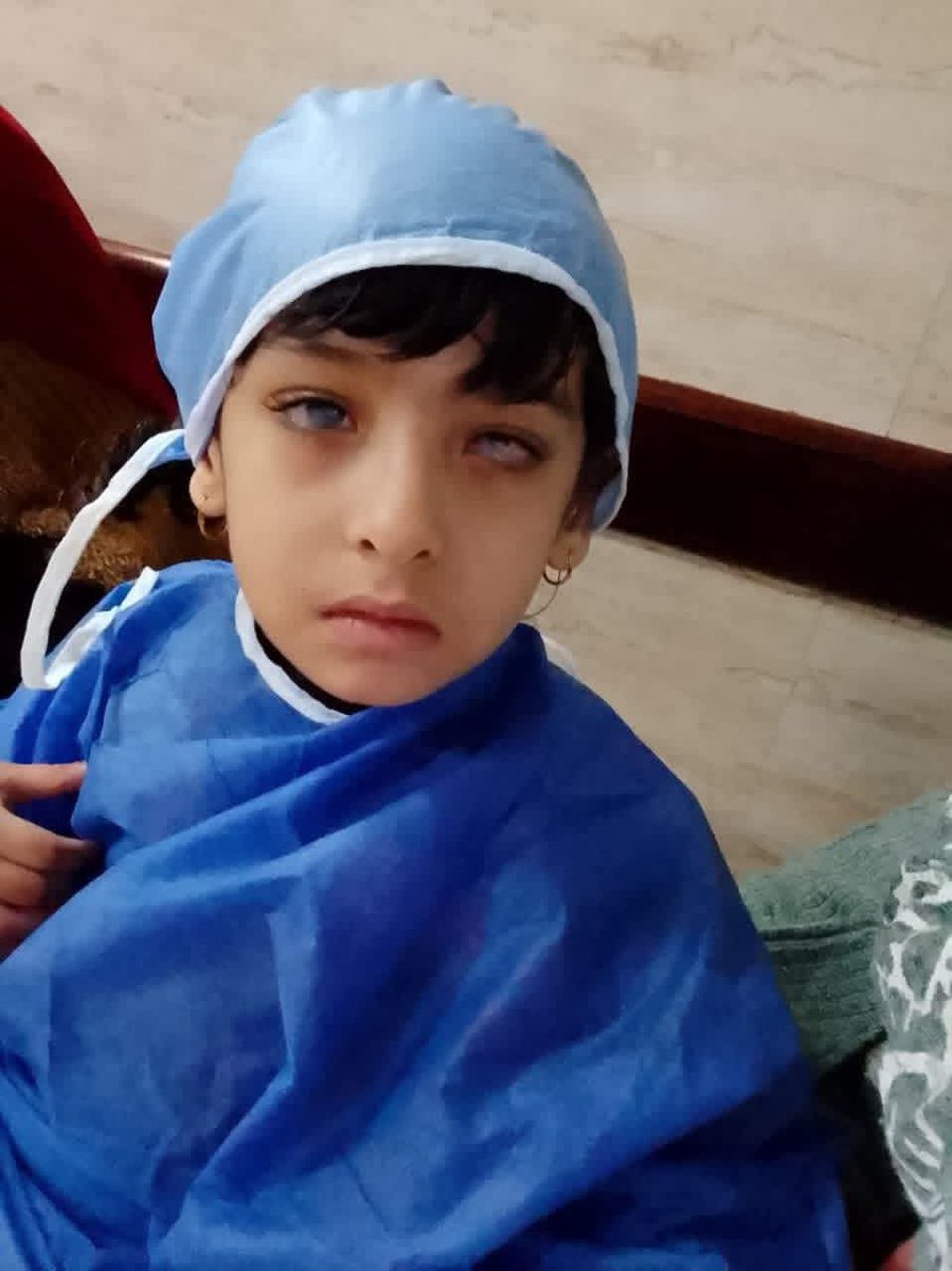 tayseryaser's tweet photo. طفلة يتيمه
الحالة دي مش هكتب عنها كتير لان شكل البنت واضح 
البنت هتفقد عينها وتعيش باقي عمرها كفيفه لان التعب كان في عين والتانيه بدأت تتأثر الحاله صعبه جداً جداً 
تكلفة العملية 30 الف جنيه 
موصلناش غير ٥٠٠٠ بس
متاح التواصل مع الحاله https://t.co/eYz6nvFp0L
