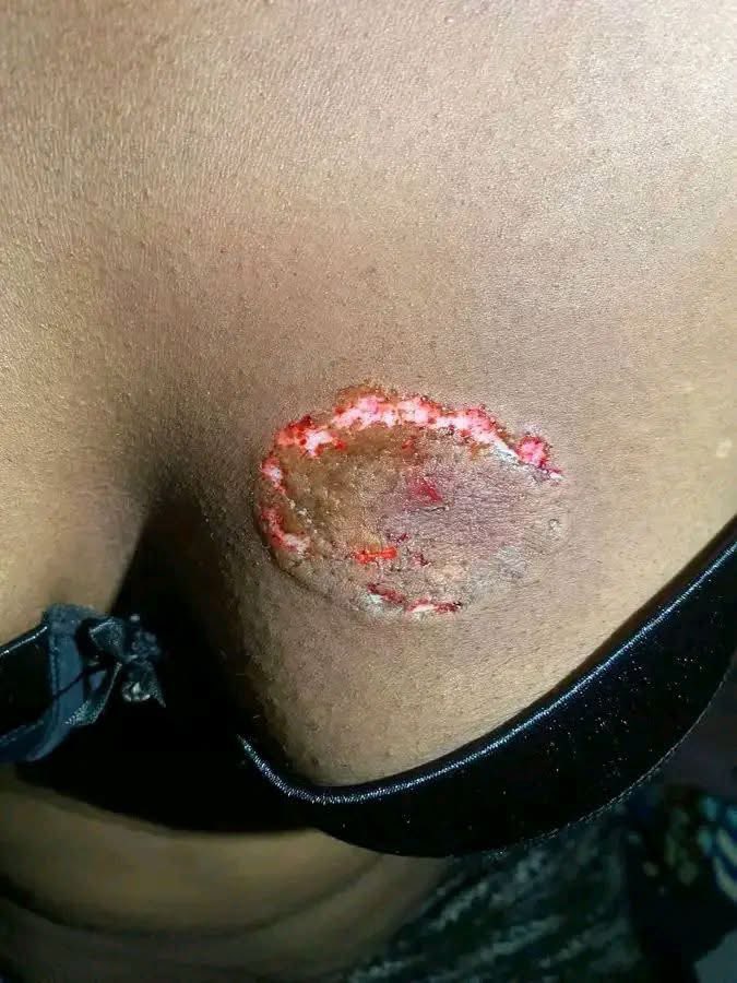 uclemuclem's tweet photo. I know una like gist but that will be later 🥶.
What do you think caused this type of injúry?  #oncode https://t.co/SvIGz7yTV6