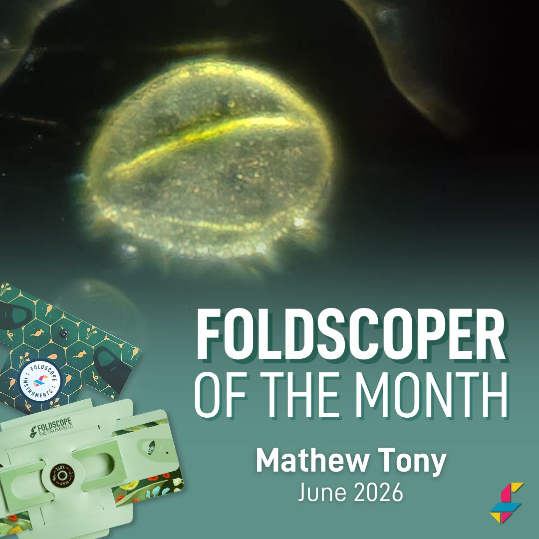 TeamFoldscope's tweet photo. ✨ Our June Foldscoper of the Month, Mathew Tony, has embraced scientific exploration through his participation in the Lodha Genius–Ashoka University Program, a prestigious initiative designed to nurture India's brightest young minds and future changemakers. Through the program, this student has had the opportunity to explore the microscopic world using Foldscope and share his discoveries on Microcosmos.

🔬 Working alongside educator, researcher, and Foldscope expert Anupma Harshal, he examined a wide variety of specimens, including pollen, insects, and many other fascinating samples.

📚 The Lodha Genius–Ashoka University Program provides students with immersive experiences in science and mathematics, mentorship opportunities, and access to leading experts from around the world. Mathew's enthusiasm for microscopy and his active participation in Foldscope-based investigations exemplify the spirit of discovery and innovation that the program encourages.

🥳 We are excited to recognize Mathew for his dedication to exploring the unseen world and for sharing his findings with the global Foldscope community!