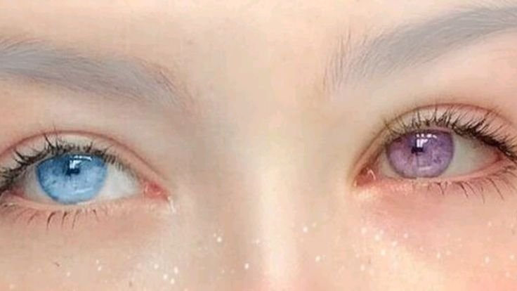 studio_peep's tweet photo. If I had to choose an issue to have, heterochromia would be it. It's so beautiful yet has vision issues. 💔 #heterochromia https://t.co/Vcbd07GKRQ