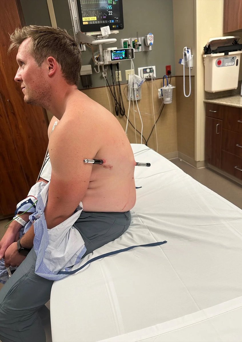 InternetH0F's tweet photo. Hiker impales himself with a trekking pole, then walks 10 miles back down Montana's tallest mountain to avoid expensive helicopter trip https://t.co/kc2nFZUQCD