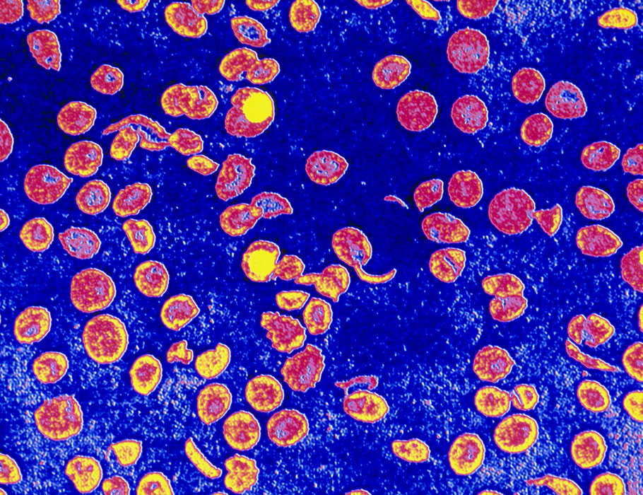 ScienceTM's tweet photo. New single-cell analyses decrypt how hematopoietic stem cells in #SickleCellDisease display signs of #senescence such as DNA damage and cell cycle disruptions, and show that senolytic drugs can restore function in vivo and ex vivo. @StJudeResearch https://t.co/Vs95lg3oNI https://t.co/ptQzNWDLUl