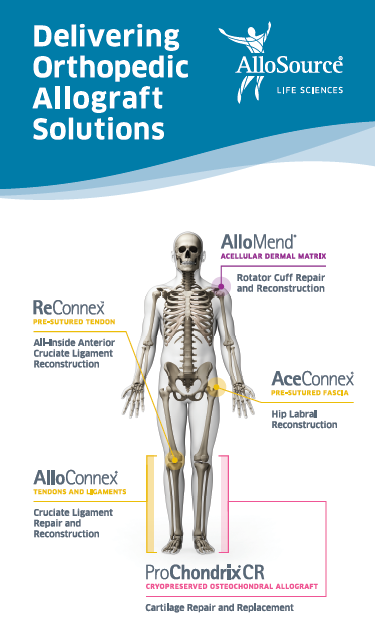 AlloSource's tweet photo. This week, we're at the Western Orthopedic Association Annual Meeting showcasing our allograft solutions portfolio, including the newly available ReConnex™, a ready-to-use sterile device designed to simplify all-inside ACL reconstruction. Learn more at https://t.co/7ecrT2ZVcy https://t.co/9ahCQkBsWk