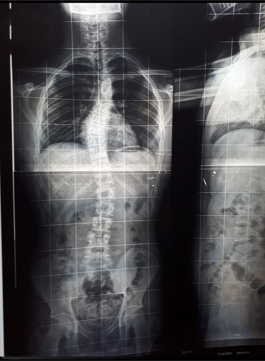 spaccacomtwiter's tweet photo. Quem tiver a coluna mais legal ganha um shot 🤪🤟 https://t.co/TNfW4lA8qP
