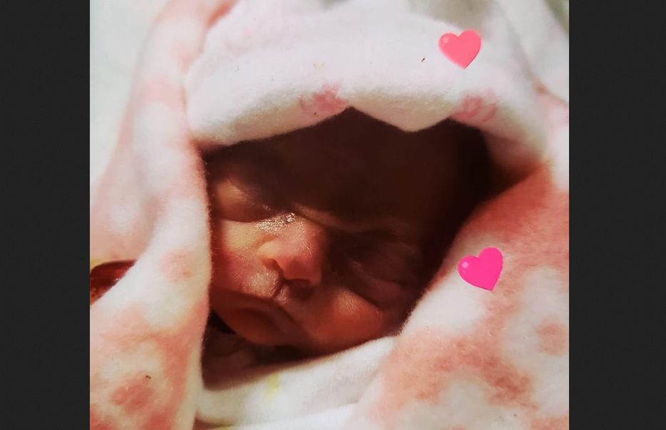 LifeNewsHQ's tweet photo. Mom Shares Photo of 22-Week-Old Baby Who Died After Birth to Show Humanity of Unborn Children https://t.co/TiOhrL2Gqj https://t.co/1AfueTfJIu